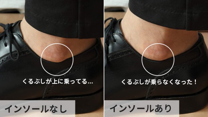 革靴のくるぶしが当たって痛い時の対処法 カカトのインソールなど Kutsumedia